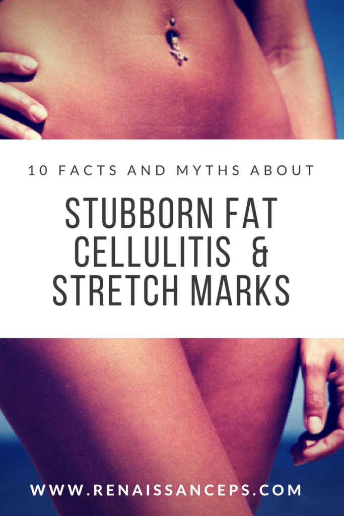 10 FACTS ABOUT CELLULITE, STRETCH MARKS & FAT 1 fat-cellulite-stretch-marks