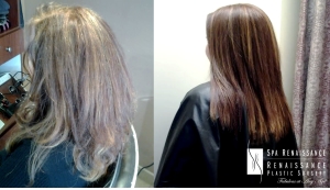 Smoothing Treatments